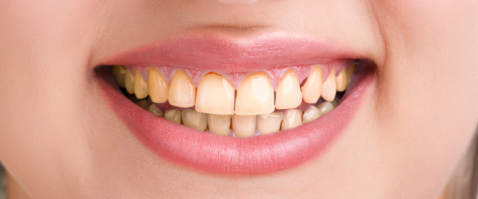 teeth_2 (1) teeth_2 (1)